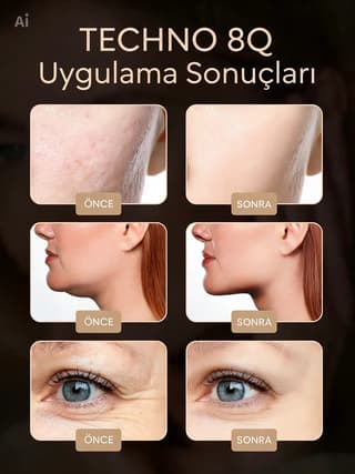 Mikroakım EMS Çift Makaralı V-Yüz Güzellik ve Masaj Aleti - 4
